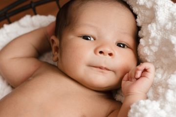 Những bệnh về mắt thường gặp ở trẻ sơ sinh