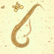 Bệnh nhiễm ký sinh trùng giun lươn