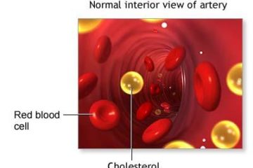 Tìm hiểu về cholesterol và những phương pháp hạn chế cholesterol xấu