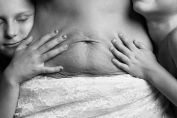 Bộ ảnh chân thực hé lộ cơ thể người mẹ sau khi sinh