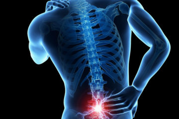 Phục hồi chức năng bệnh đau cột sống thắt lưng