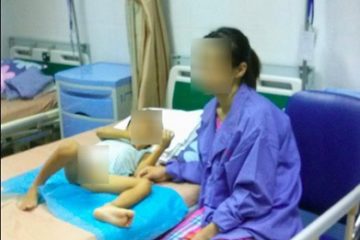 Hưng Yên: Công an vào cuộc điều tra vụ hàng loạt trẻ mắc sùi mào gà