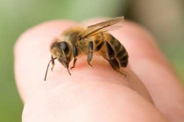 Nhiễm độc do ong đốt