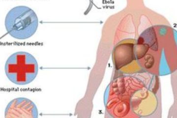 Hướng dẫn chẩn đoán và điều trị bệnh do vi rút Ebola của Bộ Y tế