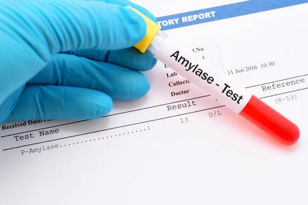 xét nghiệm sinh hóa amylase