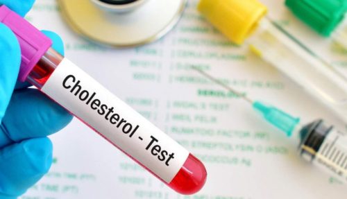 xét nghiệm sinh hóa cholesterol