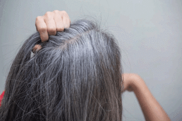 Căng thẳng có làm bạn bạc tóc
