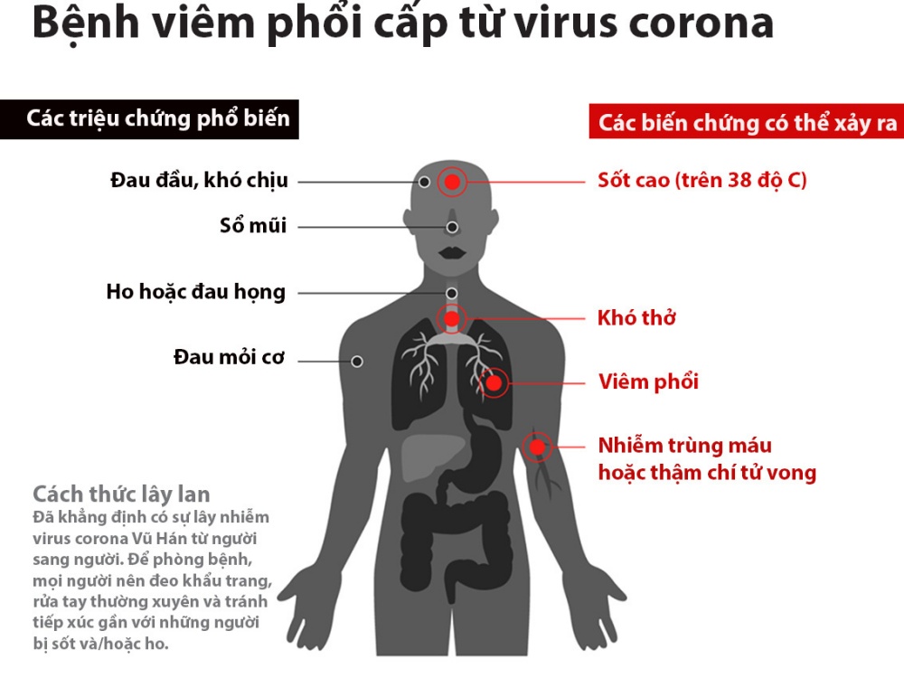 viêm đường hô hấp cấp do virus Corona