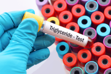 Chỉ số Triglyceride trong máu như thế nào là cao?