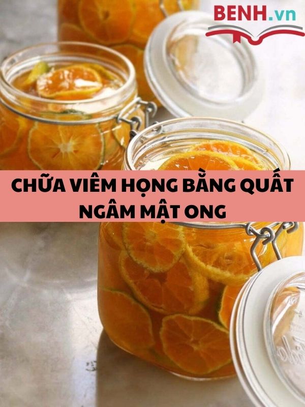 meo-chua-viem-hong-man-tinh-theo-dan-gian-va-luu-y-khi-dieu-tri-7