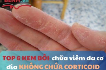 top-6-kem-boi-chua-viem-da-co-dia-o-tay-khong-chua-corticoid-1